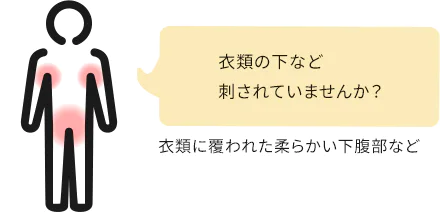 衣類の下など刺されていませんか？ 衣類に覆われた柔らかい下腹部など