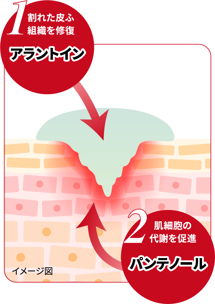何度もくり返すパックリ割れに｜ヒビケア軟膏｜池田模範堂