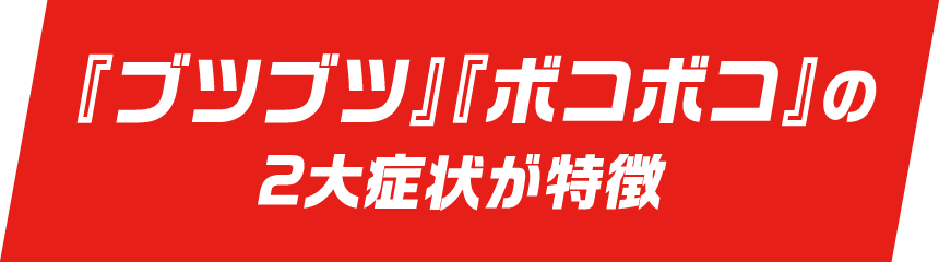 『ブツブツ』『ボコボコ』の2大症状が特徴