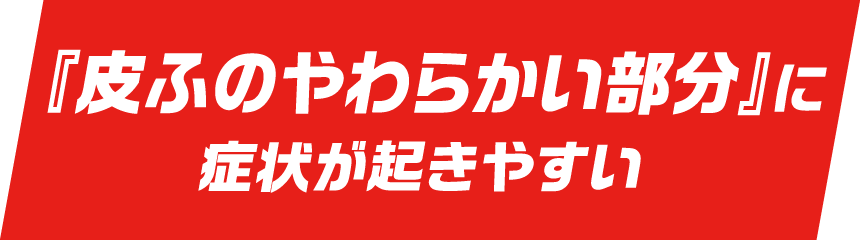 『皮ふのやわらかい部分』に症状が起きやすい